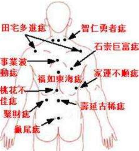 屁股右邊有痣|痣在屁股有何寓意？